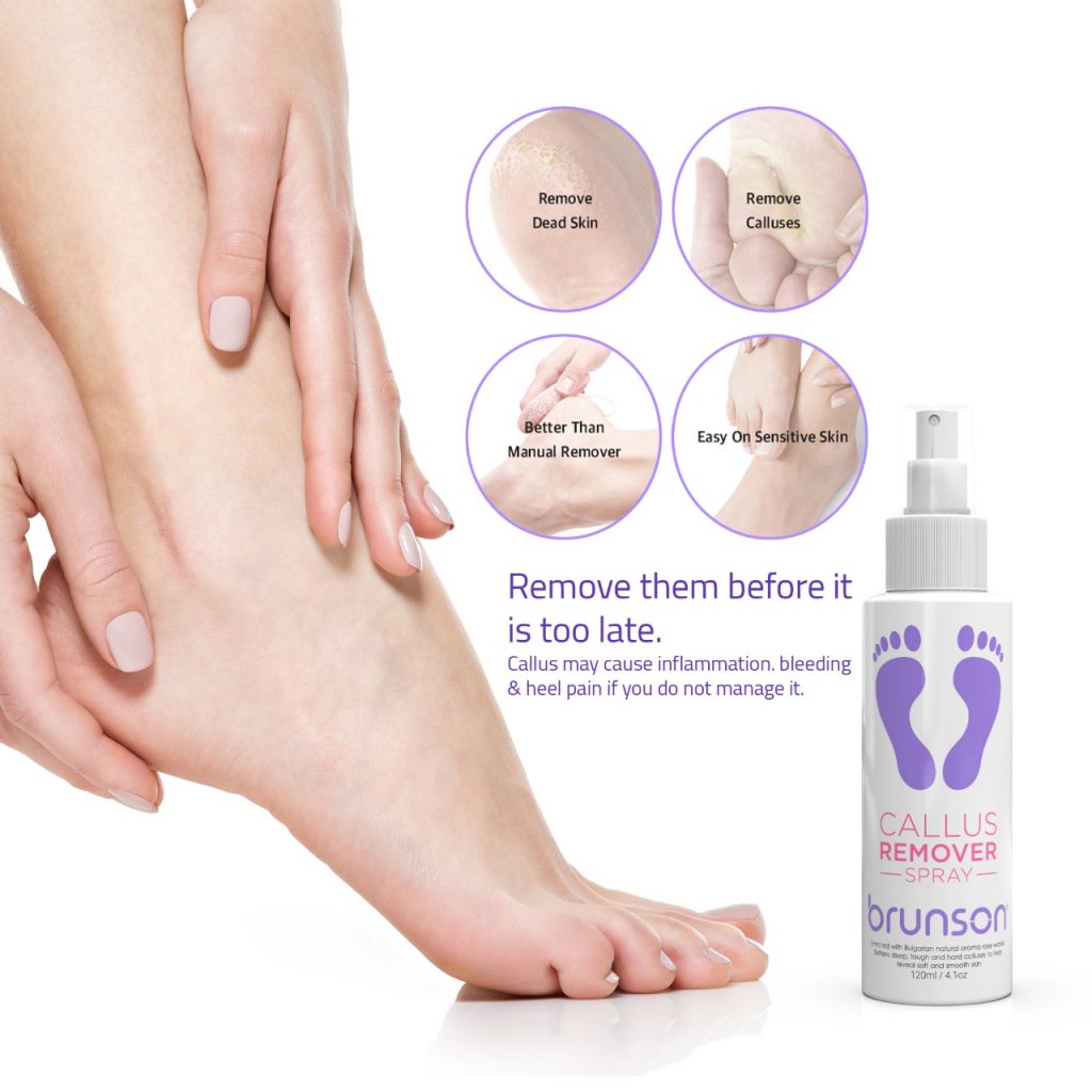 Callus Remover Spray | Best Pedicure Tool | Brunson